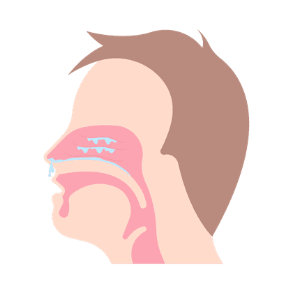 Sinusitis, frontitis, haymoritis